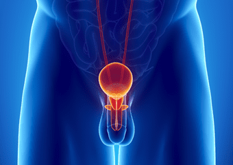 Signs and symptoms of Testicular Cancer