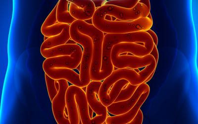 Symptoms of Neuroendocrine Cancer of the Small Bowel