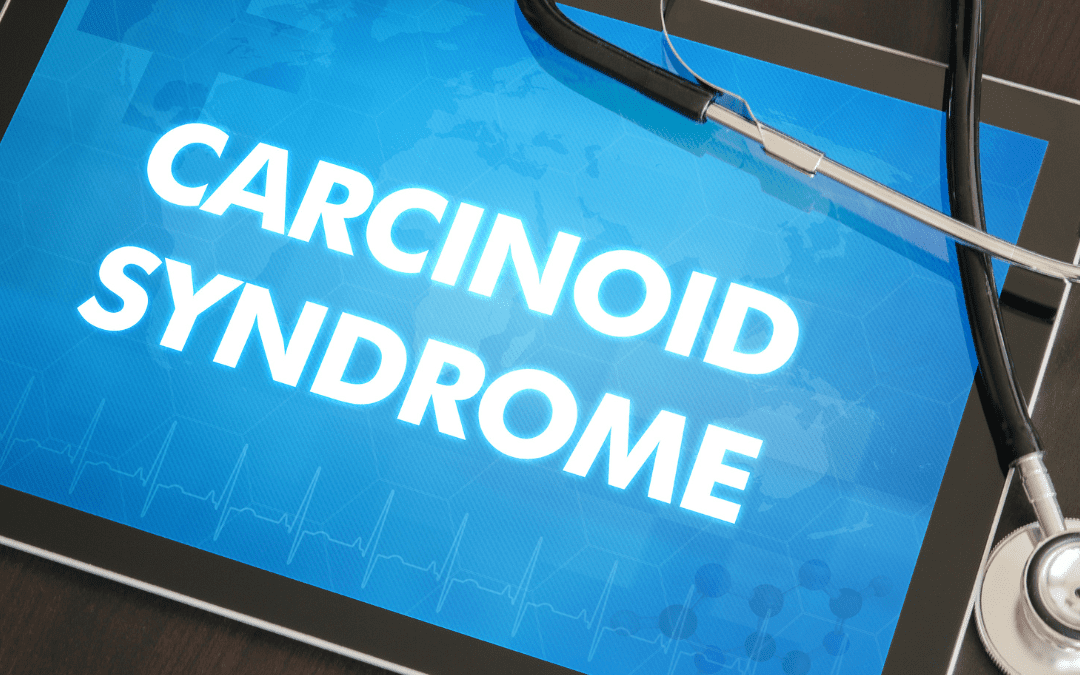 Review of Carcinoid Syndrome